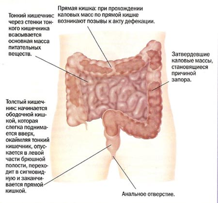 Запоры