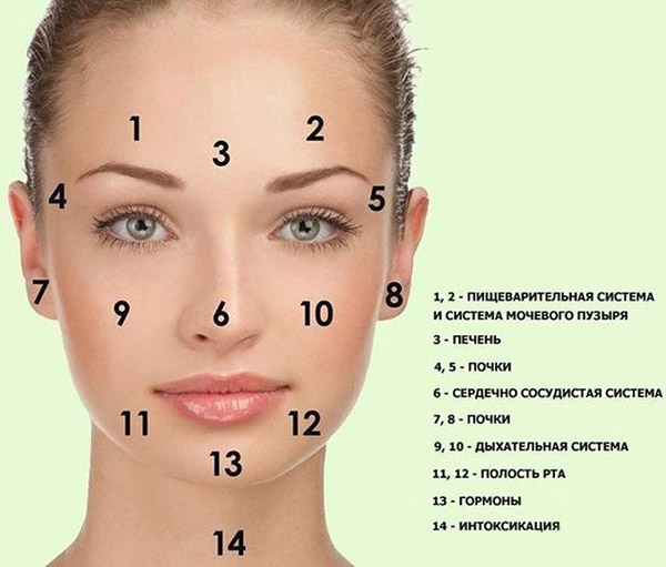 Прыщи на лице: что означает их распределение?