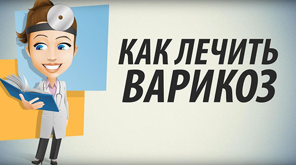 Как лечить варикоз в домашних условиях народными средствами