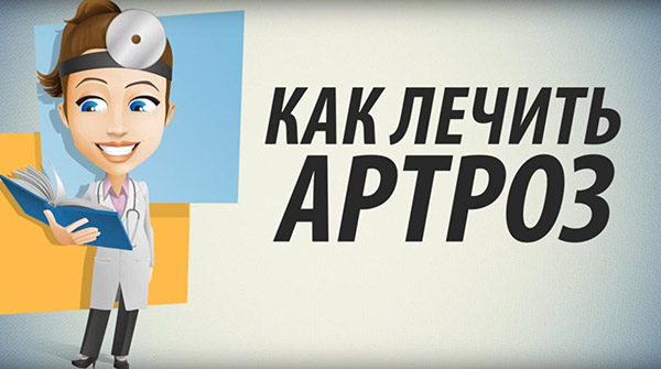 Как лечить артроз суставов