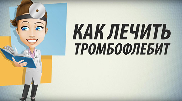 Как лечить тромбофлебит