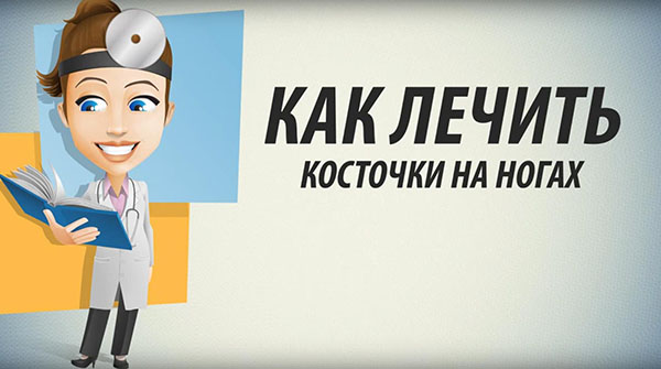 Как лечить косточки на ногах народными методами