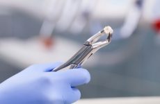 Удаление зубов в стоматологии: эффективные методы и важные нюансы