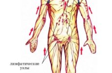 Как रक्तhack в борьбе с женскими болезнями