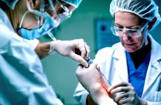Биоимплант Bio-Osteo для суставов в СПб: быстро и без хирургии