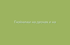 Гнойнички на деснах и на поверхности ротовой полости, лечение народными средствами