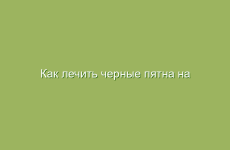 Как лечить черные пятна на лице?