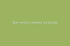 Как лечить экзему на руках, ногах, пальцах рук в домашних условиях