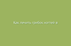 Как лечить грибок ногтей в домашних условиях народными средствами