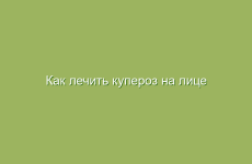 Как лечить купероз на лице народными средствами