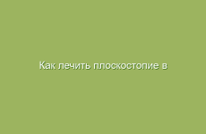 Как лечить плоскостопие в домашних условиях