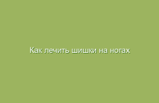 Как лечить шишки на ногах народными средствами