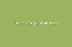 Как лечить цыпки на руках народными методами