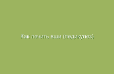 Как лечить вши (педикулез) народными средствами в домашних условиях