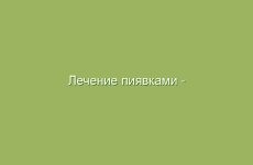 Лечение пиявками — Гирудотерапия