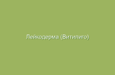 Лейкодерма (Витилиго) лечение народными средствами в домашних условиях