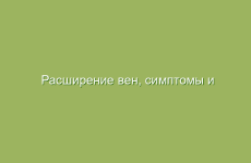 Расширение вен, симптомы и лечение народными средствами