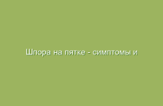 Шпора на пятке — симптомы и лечение в домашних условиях